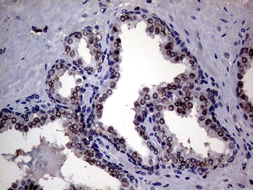 Monoclonal Mouse anti-Human UPRT Antibody (clone OTI1D12, IHC, WB)