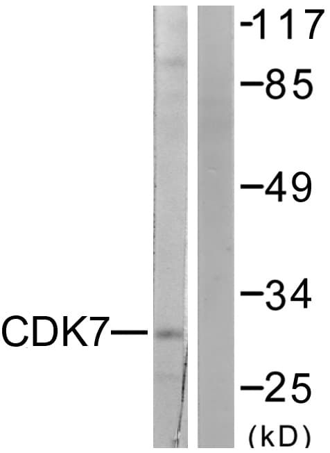 Polyclonal Rabbit anti-Human CDK7 Antibody (aa291-340, IHC, WB)