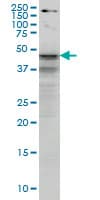 IHC-plus™ SHBG Antibody (clone 5E6)