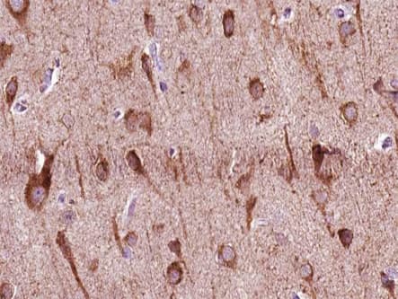 Polyclonal Rabbit anti-Human ZNF287 Antibody (IHC, IF, WB)