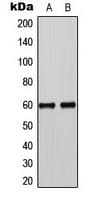 SMAD3 Antibody (phospho-Ser425)