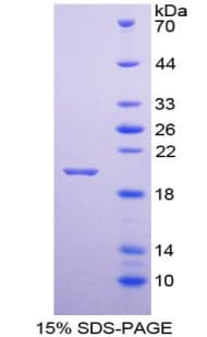 Rat NMU / Neuromedin U Protein (Recombinant His-T7)
