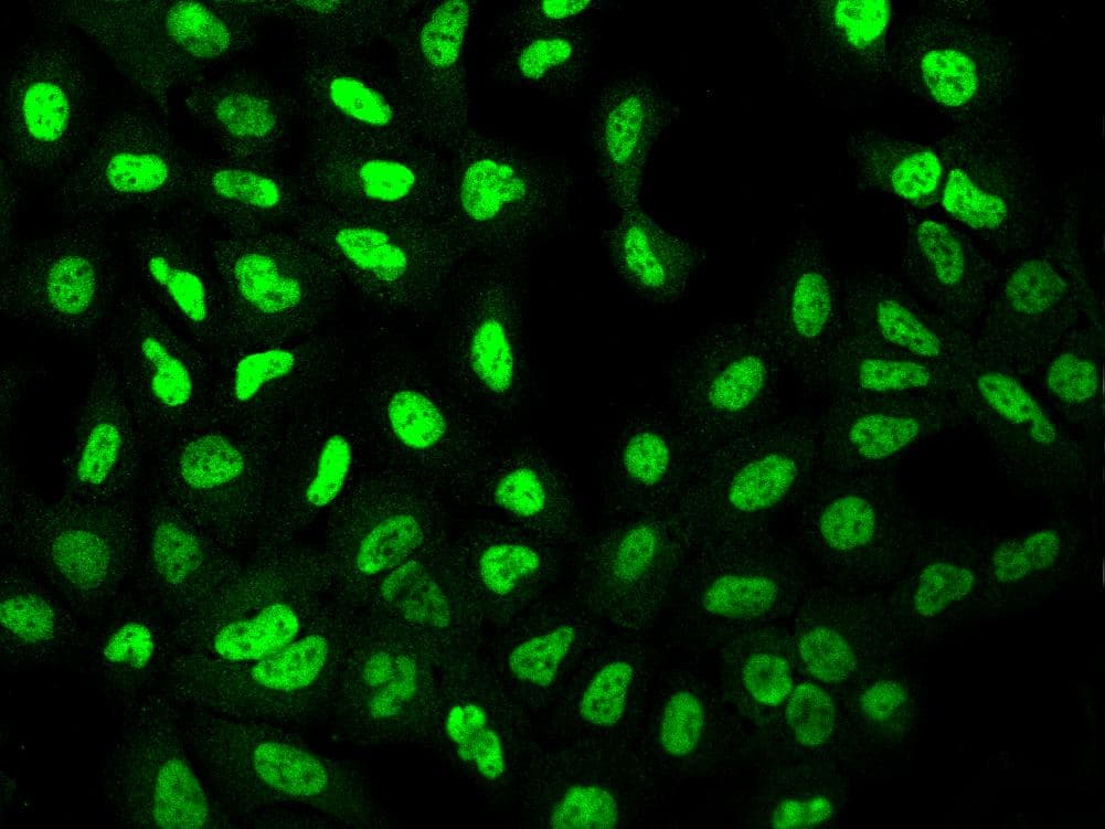 Polyclonal Rabbit anti-Human OGFR Antibody (IF)