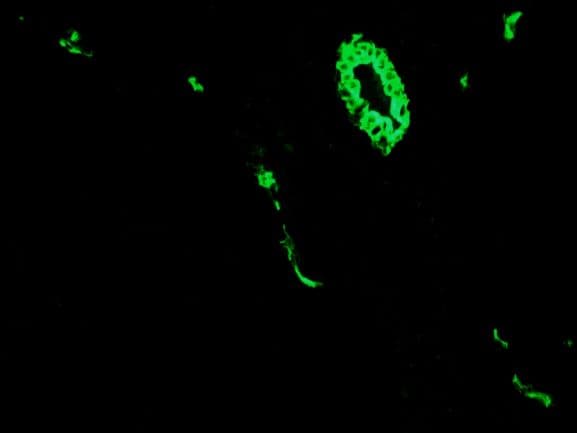 IHC-plus™ KRT7 / CK7 / Cytokeratin 7 Antibody (clone RCK105)