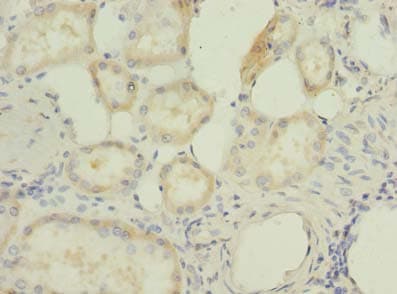 RBBP9 Antibody