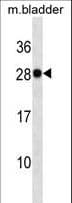LGALS3 / Galectin 3 Antibody (aa138-167)
