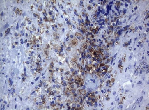 Monoclonal Mouse anti-Human CTSL / Cathepsin L Antibody (clone OTI8C12, IHC, WB)