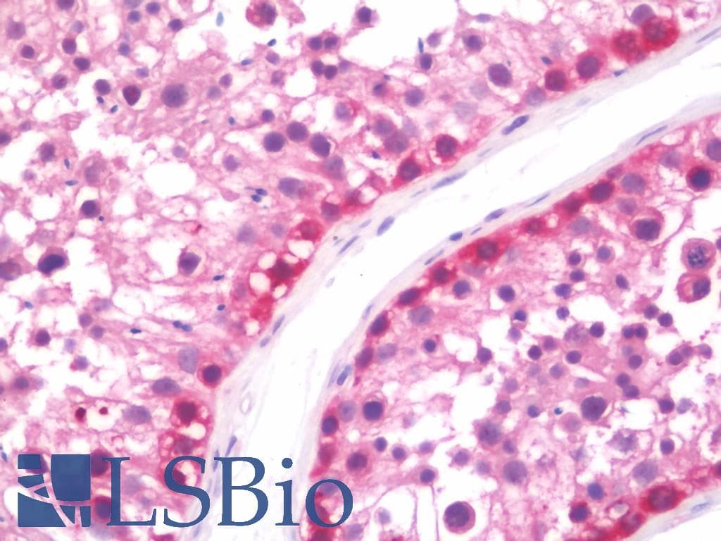 IHC-plus™ Polyclonal Rabbit anti-Human IMPDH1 Antibody (aa84-113, IHC, WB)