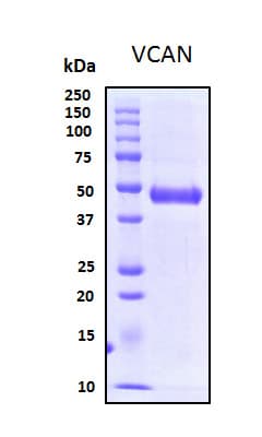 Human VCAN / Versican Protein (Recombinant His, N-Terminal)