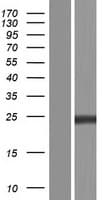 RAB5C Protein (Over-Expression Lysate Myc-DDK (Flag))