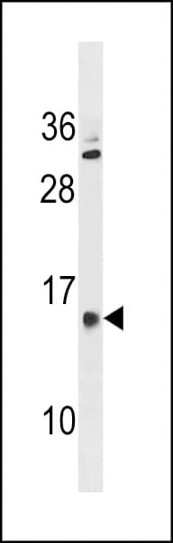 Polyclonal Rabbit anti-Human GALNTL5 Antibody (aa52-80, WB)