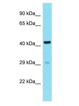 CDRT15L2 Antibody (aa86-135)