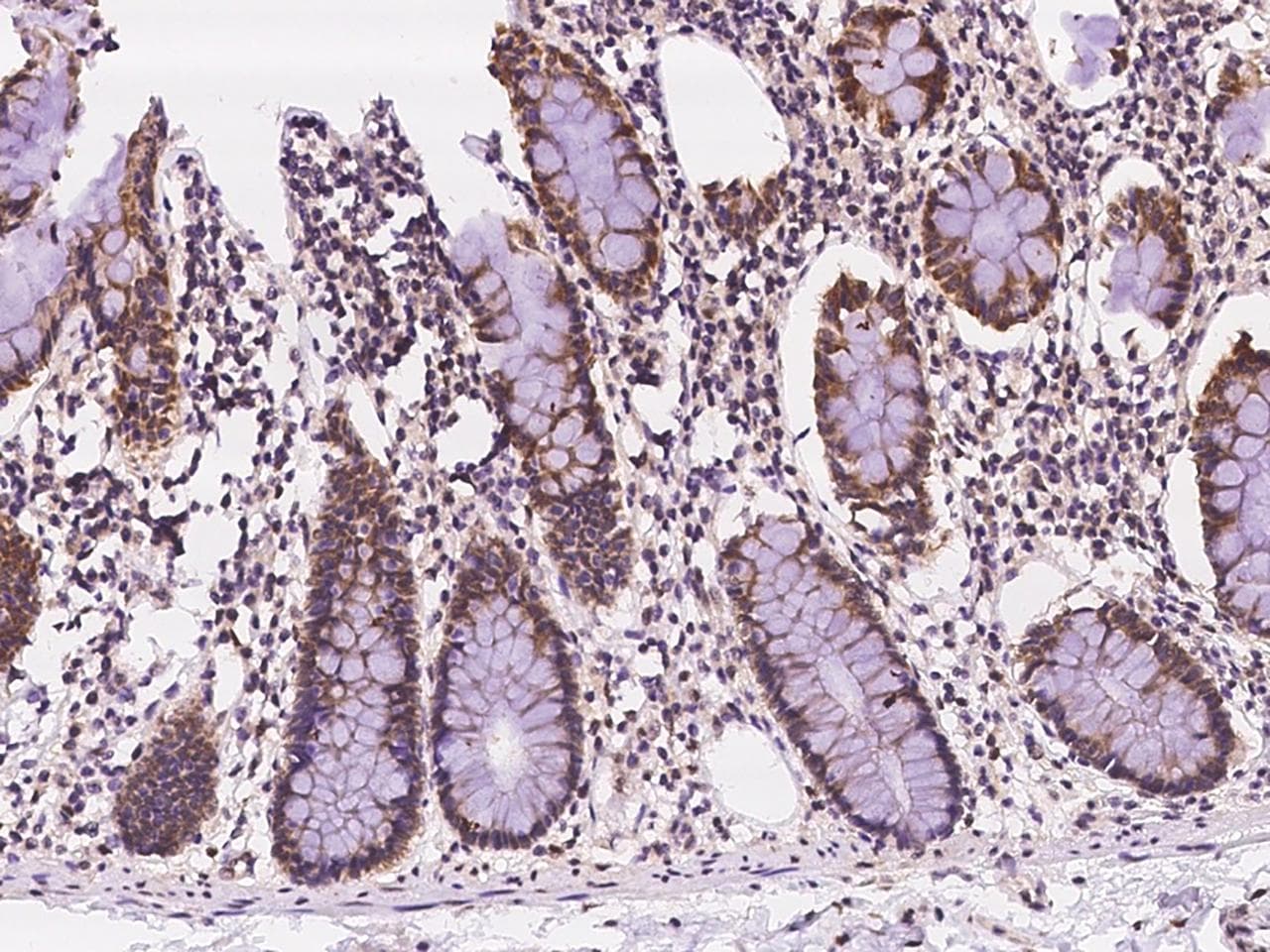 C19orf44 Antibody