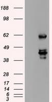 IHC-plus™ SSB / La Antibody (clone 1E11)