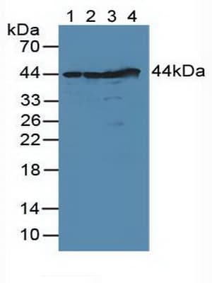 DFFA / ICAD / DFF45 Antibody (aa51-305, Biotin)