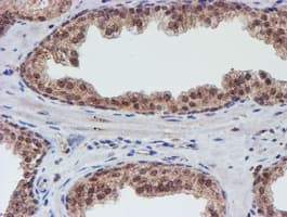 VCAM1 / CD106 Antibody (clone OTI4E8)