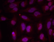 MYC / c-Myc Antibody