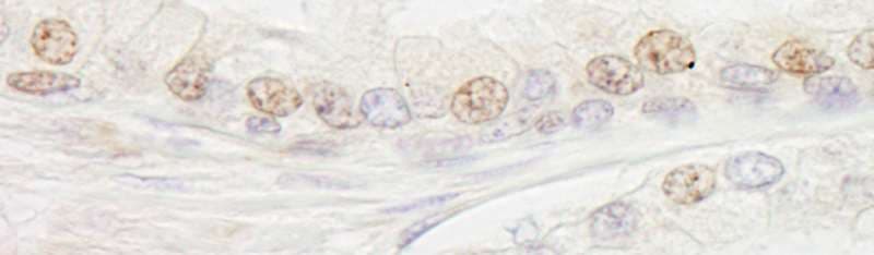 ERCC3 / XPB Antibody (aa575-625)
