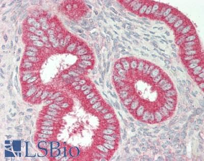 IHC-plus™ CAPN1 / Calpain 1 Antibody (aa1-420, clone 1376CT809.24.85)