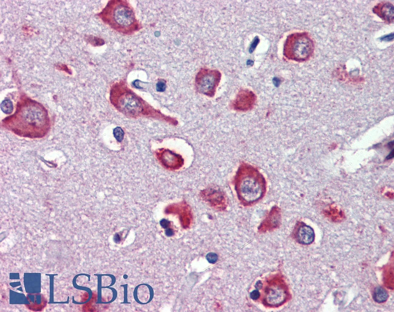 PathPlus™ CHRNA7 Antibody