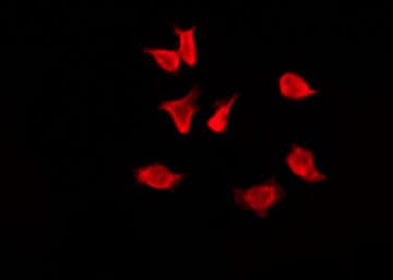 OR4F4 Antibody