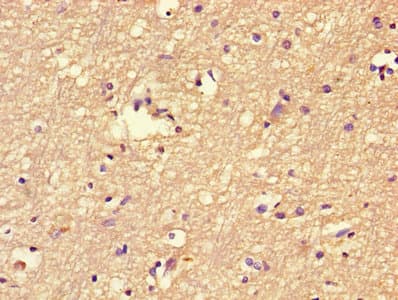 Polyclonal Rabbit anti-Human FBXL18 Antibody (WB)