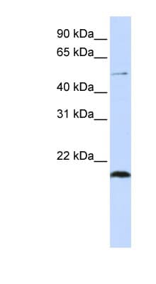 Polyclonal Rabbit anti-Human ZNF683 Antibody (N-Terminus, WB)