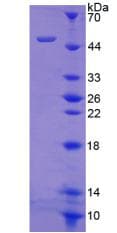 Human ITGA8 / Integrin Alpha 8 Protein (Recombinant His-GST-S)