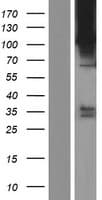 ROR2 Protein (Over-Expression Lysate Myc-DDK (Flag))