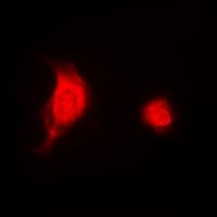 Polyclonal Rabbit anti-Human ELF3 / ESE1 Antibody (IHC, IF, WB)