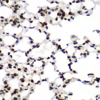 TEAD1 Antibody