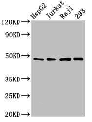 IHC-plus™ EIF4A2 Antibody (aa1-407)