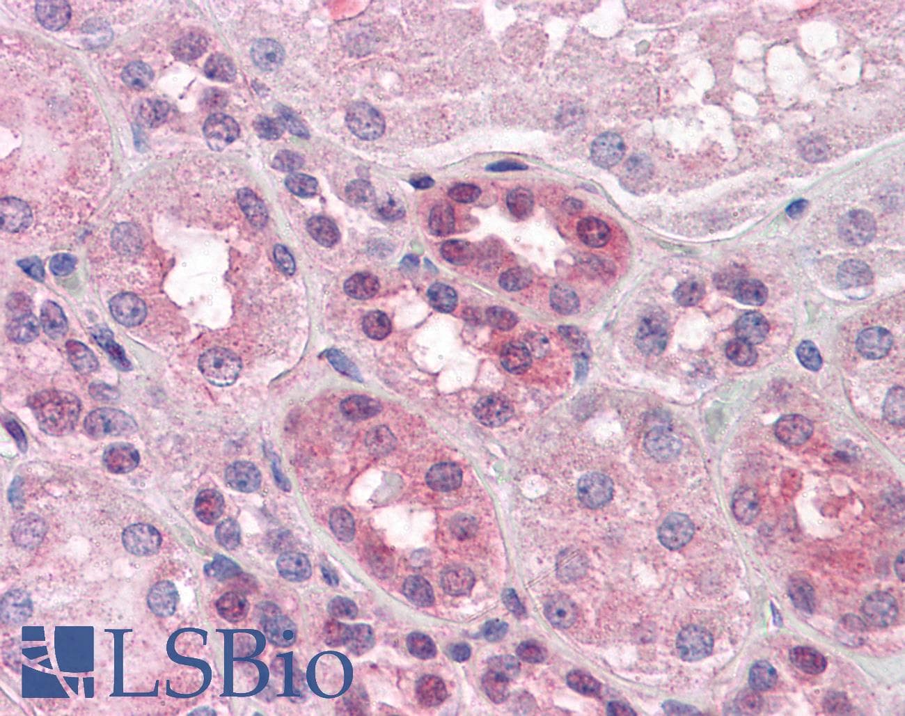 IHC-plus™ PACE4 / PCSK6 Antibody (aa637-648)