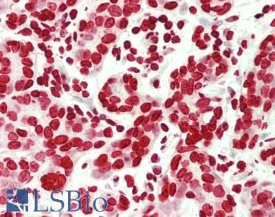 IHC-plus™ Polyclonal Rabbit anti-Human POM121 Antibody (aa1200-1249, IHC, WB)