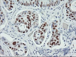 TP53 / p53 Antibody (clone OTI1D11, Carrier-free)