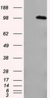 APP / Beta Amyloid Precursor Antibody (clone OTI3D11)