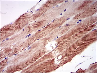 NPC / NPC1 Antibody (aa34-174, clone 8D10B6)