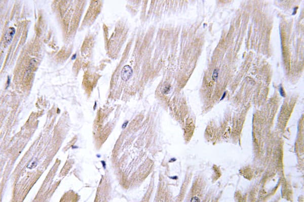 DNAJB11 Antibody (Lys66)
