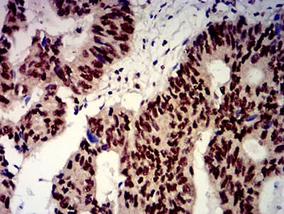 BTRCP / BETA-TRCP Antibody (clone 4C5D8)