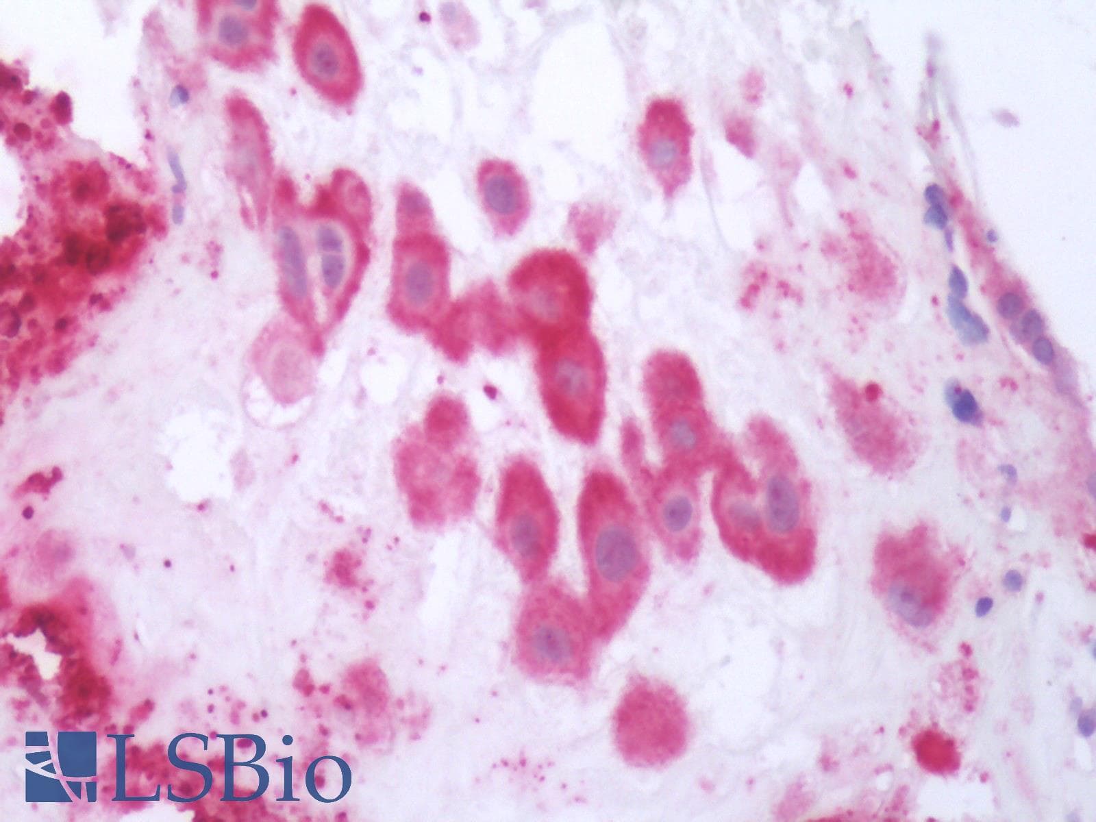 PathPlus™ Polyclonal Rabbit anti-Human OXTR / Oxytocin Receptor Antibody (N-Terminus, IHC)