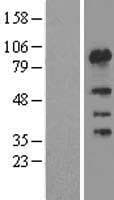 FSIP1 Protein (Over-Expression Lysate Myc-DDK (Flag))