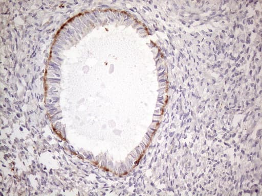 POTEG Antibody (clone OTI2G1)