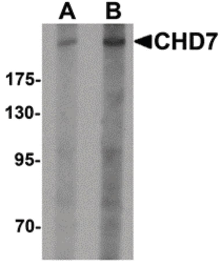 CHD7 Antibody