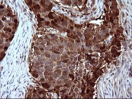 SERPINB3 Antibody (clone OTI1A5)
