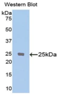 PECAM-1 / CD31 Antibody (aa421-629, Biotin)