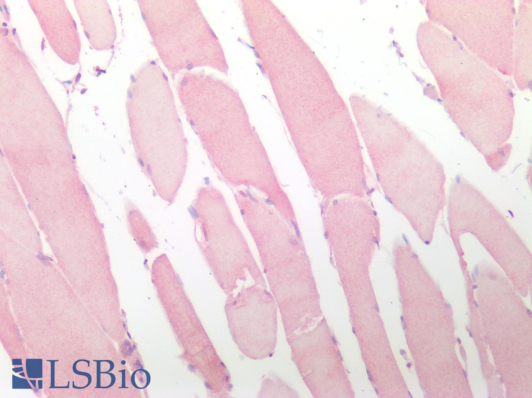 IHC-plus™ CTSK / Cathepsin K Antibody
