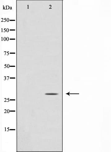 ANP32C Antibody