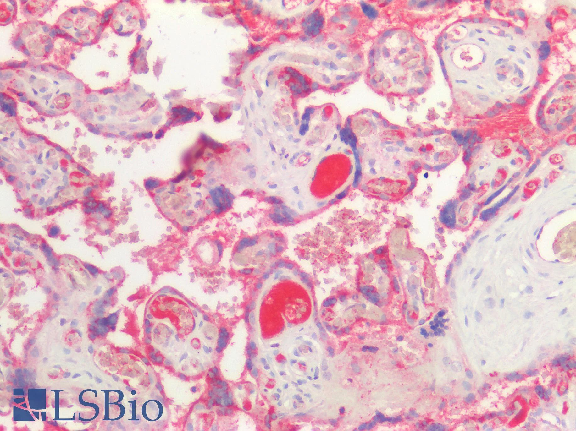 PathPlus™ EBI3 / IL-27B Antibody