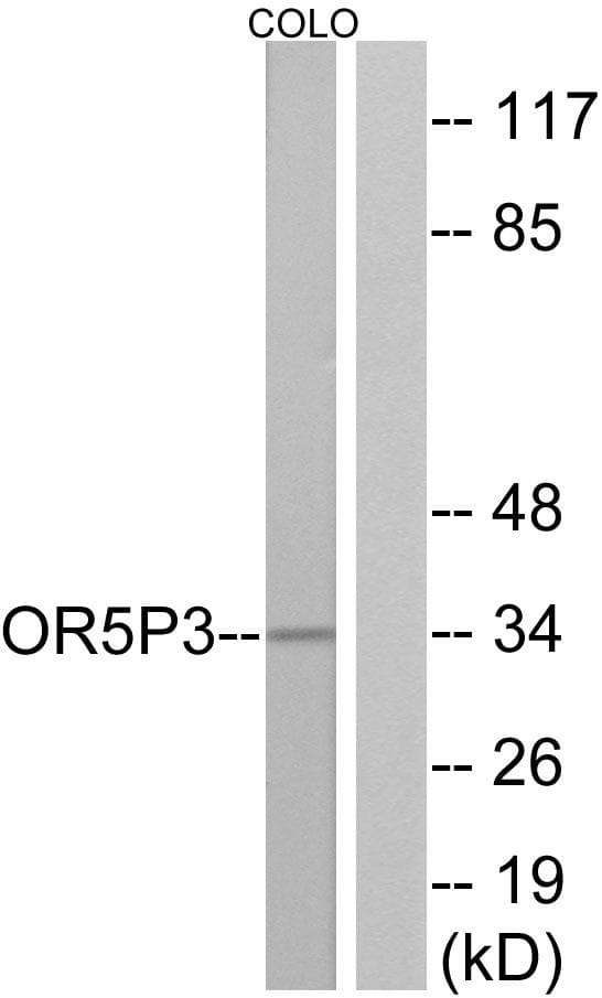Polyclonal Rabbit anti-Human JCG1 / OR5P3 Antibody (WB)