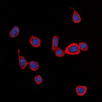 S1PR1 / EDG1 / S1P1 Antibody (Internal)